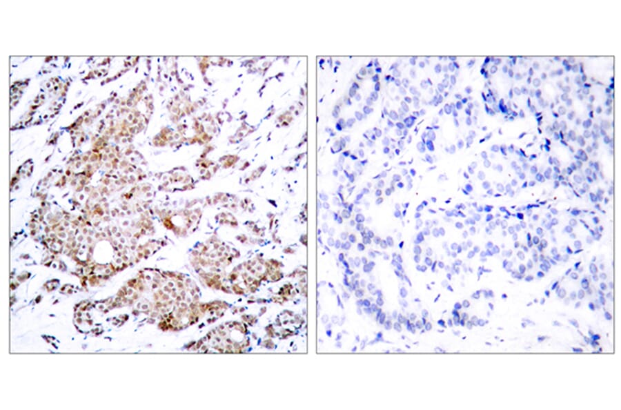Immunohistochemistry - Anti-Myc (phospho Thr58) Antibody (A7159) - Antibodies.com