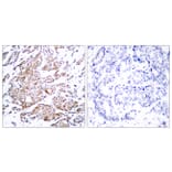 Immunohistochemistry - Anti-Myc (phospho Thr58) Antibody (A7159) - Antibodies.com