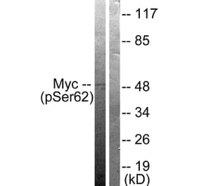 Western Blot - Anti-Myc (phospho Ser62) Antibody (A0020) - Antibodies.com