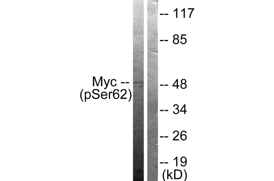 Western Blot - Anti-Myc (phospho Ser62) Antibody (A0020) - Antibodies.com