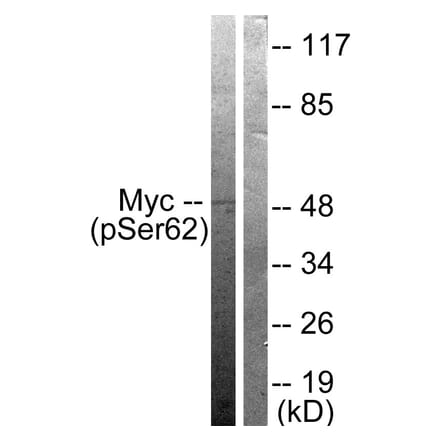 Western Blot - Anti-Myc (phospho Ser62) Antibody (A0020) - Antibodies.com