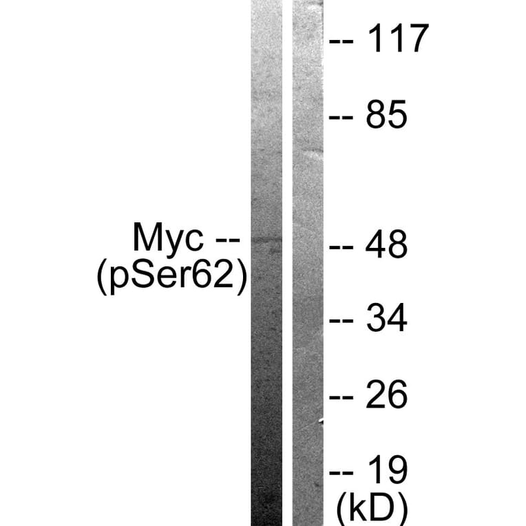 Western Blot - Anti-Myc (phospho Ser62) Antibody (A0020) - Antibodies.com