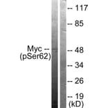 Western Blot - Anti-Myc (phospho Ser62) Antibody (A0020) - Antibodies.com