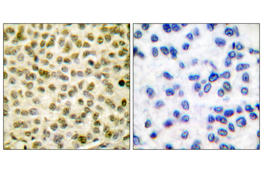 Immunohistochemistry - Anti-Myc (phospho Ser62) Antibody (A0020) - Antibodies.com
