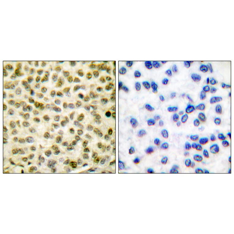 Immunohistochemistry - Anti-Myc (phospho Ser62) Antibody (A0020) - Antibodies.com