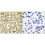Immunohistochemistry - Anti-Myc (phospho Ser62) Antibody (A0020) - Antibodies.com