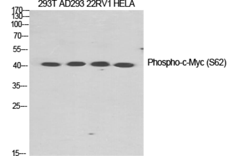 Western Blot - Anti-Myc (phospho Ser62) Antibody (A0020) - Antibodies.com