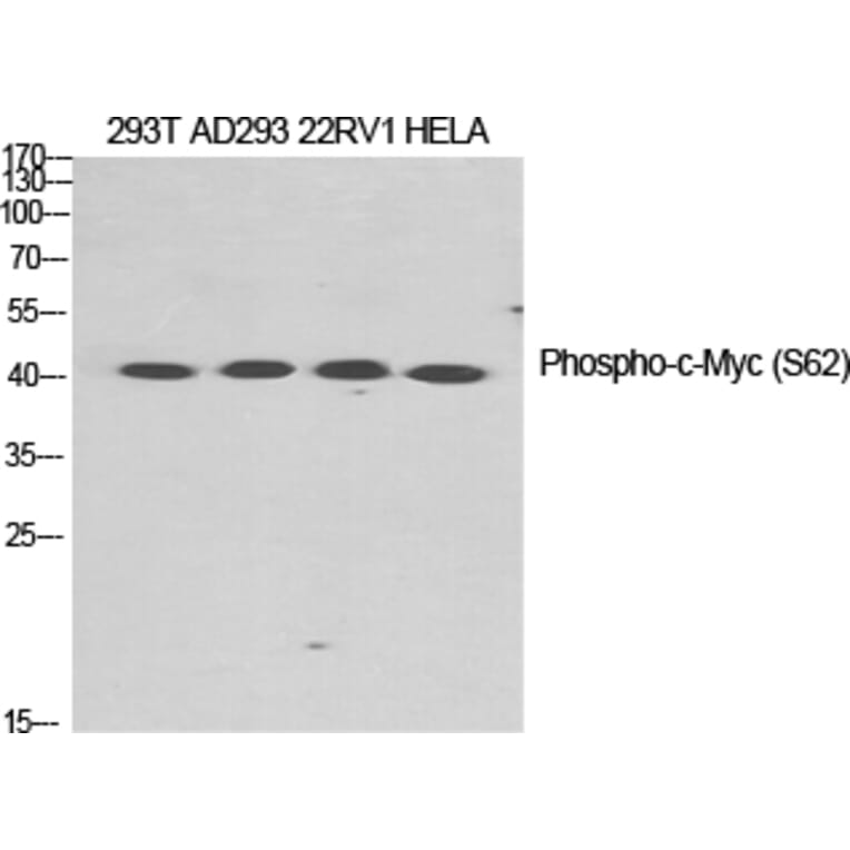 Western Blot - Anti-Myc (phospho Ser62) Antibody (A0020) - Antibodies.com