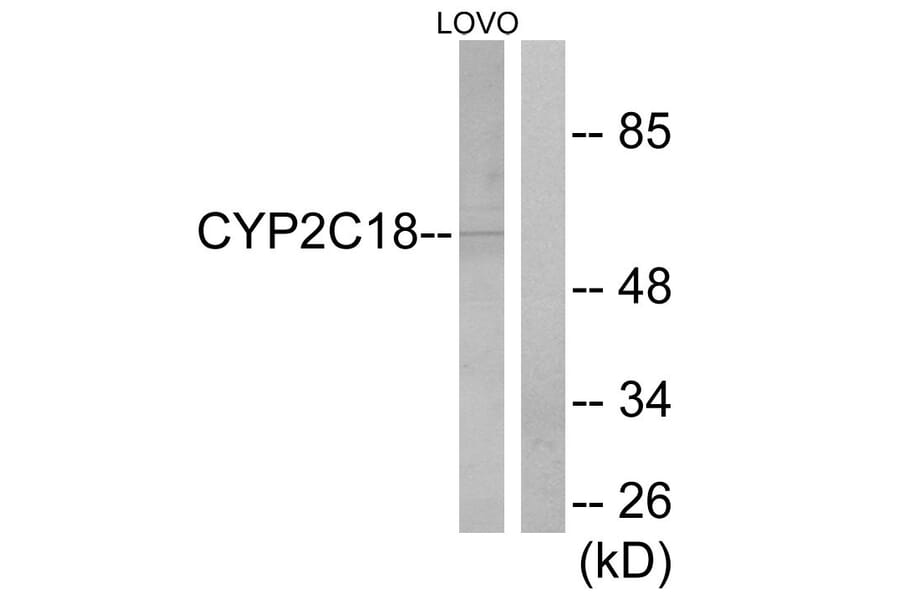 Western Blot - Anti-Cytochrome P450 2C8 + 9 + 18 + 19 Antibody (C12264) - Antibodies.com