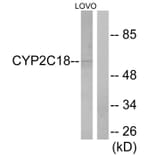 Western Blot - Anti-Cytochrome P450 2C8 + 9 + 18 + 19 Antibody (C12264) - Antibodies.com