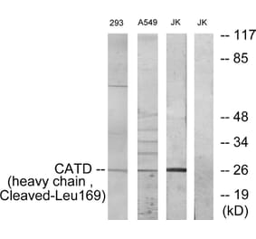 Western Blot - Anti-CATD (heavy chain,cleaved Leu169) Antibody (L0176) - Antibodies.com