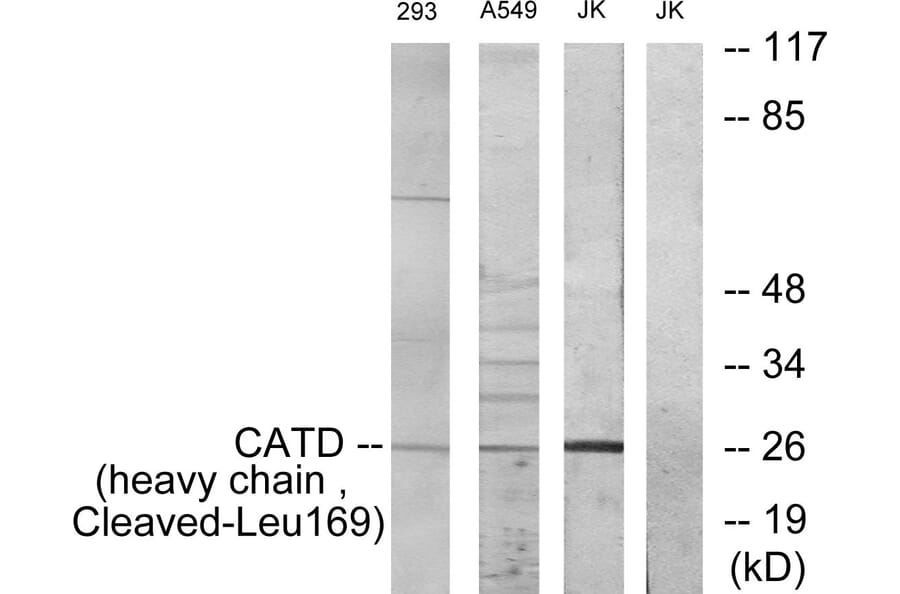 Western Blot - Anti-CATD (heavy chain,cleaved Leu169) Antibody (L0176) - Antibodies.com