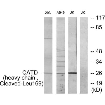 Western Blot - Anti-CATD (heavy chain,cleaved Leu169) Antibody (L0176) - Antibodies.com