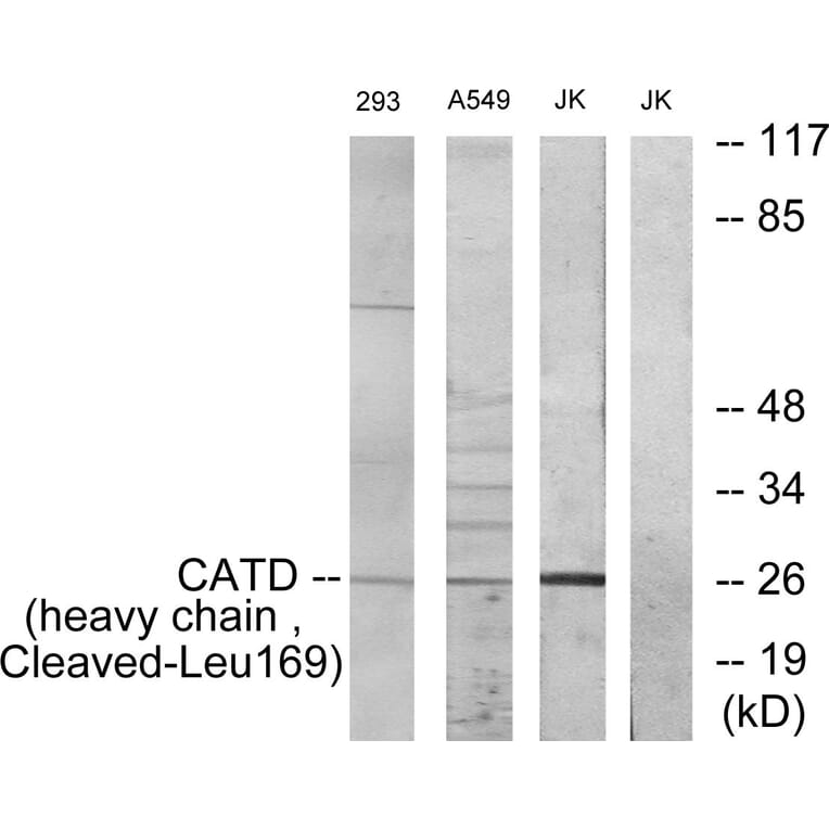 Western Blot - Anti-CATD (heavy chain,cleaved Leu169) Antibody (L0176) - Antibodies.com