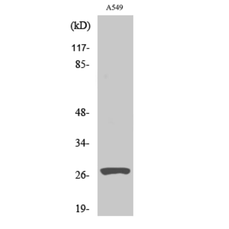 Western Blot - Anti-CATD (heavy chain,cleaved Leu169) Antibody (L0176) - Antibodies.com