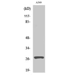 Western Blot - Anti-CATD (heavy chain,cleaved Leu169) Antibody (L0176) - Antibodies.com