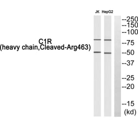 Western Blot - Anti-C1R (heavy chain, cleaved Arg463) Antibody (L0229) - Antibodies.com