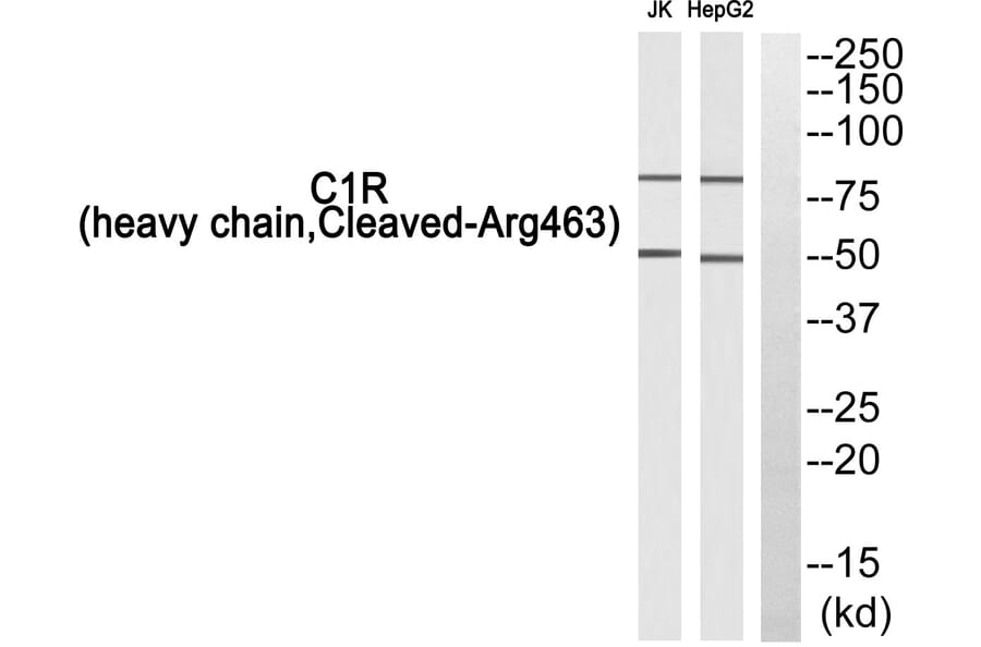 Western Blot - Anti-C1R (heavy chain, cleaved Arg463) Antibody (L0229) - Antibodies.com
