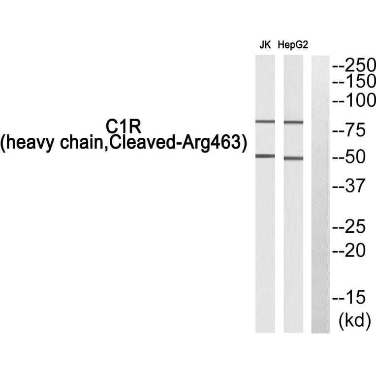 Western Blot - Anti-C1R (heavy chain, cleaved Arg463) Antibody (L0229) - Antibodies.com