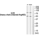 Western Blot - Anti-C1R (heavy chain, cleaved Arg463) Antibody (L0229) - Antibodies.com