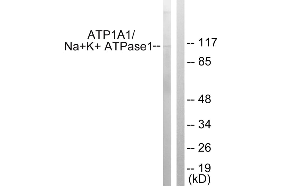Western Blot - Anti-alpha 1 Sodium Potassium ATPase Antibody (B1136) - Antibodies.com