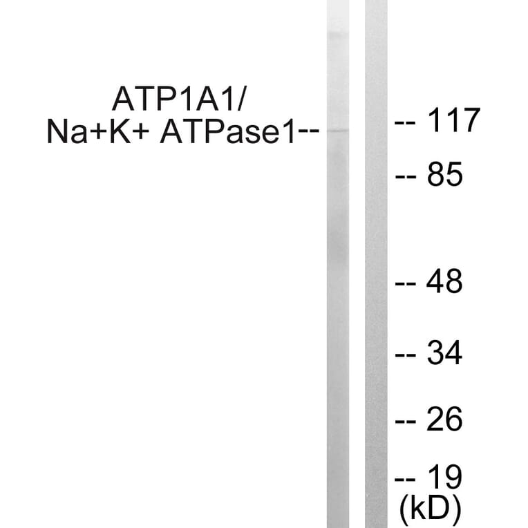 Western Blot - Anti-alpha 1 Sodium Potassium ATPase Antibody (B1136) - Antibodies.com
