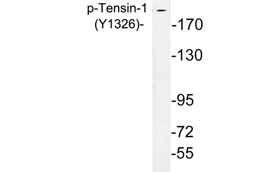 Western Blot - Anti-Tensin-1 (phospho Tyr1326) Antibody (P12-1058) - Antibodies.com