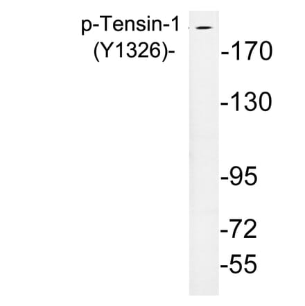 Western Blot - Anti-Tensin-1 (phospho Tyr1326) Antibody (P12-1058) - Antibodies.com