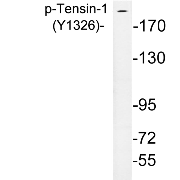Western Blot - Anti-Tensin-1 (phospho Tyr1326) Antibody (P12-1058) - Antibodies.com
