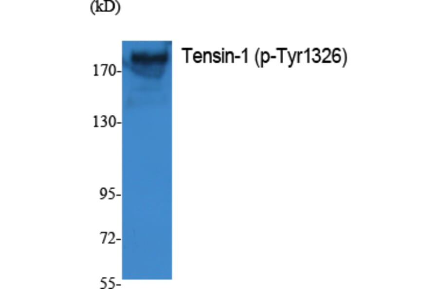 Western Blot - Anti-Tensin-1 (phospho Tyr1326) Antibody (P12-1058) - Antibodies.com