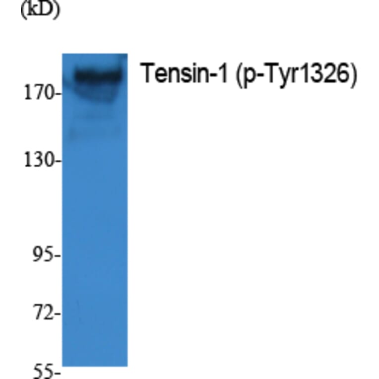 Western Blot - Anti-Tensin-1 (phospho Tyr1326) Antibody (P12-1058) - Antibodies.com