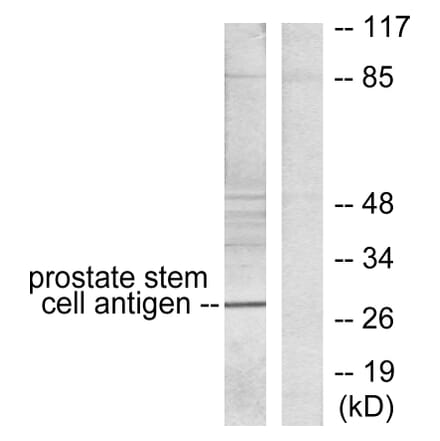 Western Blot - Anti-Prostate Stem Cell Antigen Antibody (C0310) - Antibodies.com