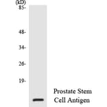 Western Blot - Anti-Prostate Stem Cell Antigen Antibody (R12-3370) - Antibodies.com