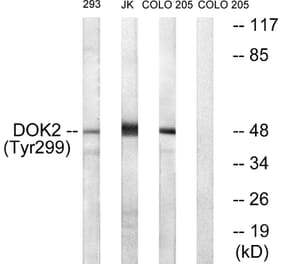 Western Blot - Anti-p56 Dok-2 (phospho Tyr299) Antibody (A7059) - Antibodies.com