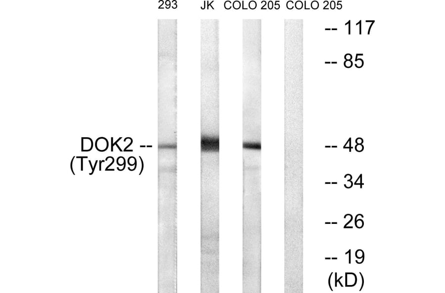 Western Blot - Anti-p56 Dok-2 (phospho Tyr299) Antibody (A7059) - Antibodies.com
