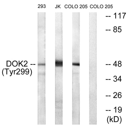 Western Blot - Anti-p56 Dok-2 (phospho Tyr299) Antibody (A7059) - Antibodies.com