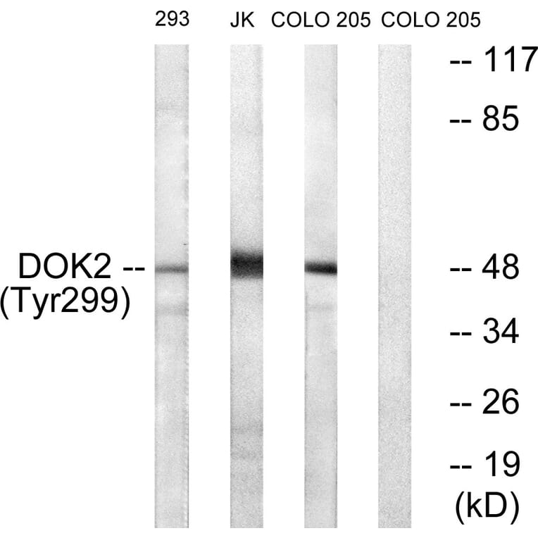 Western Blot - Anti-p56 Dok-2 (phospho Tyr299) Antibody (A7059) - Antibodies.com