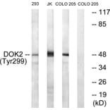 Western Blot - Anti-p56 Dok-2 (phospho Tyr299) Antibody (A7059) - Antibodies.com