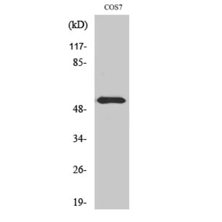 Western Blot - Anti-p56 Dok-2 (phospho Tyr299) Antibody (A7059) - Antibodies.com