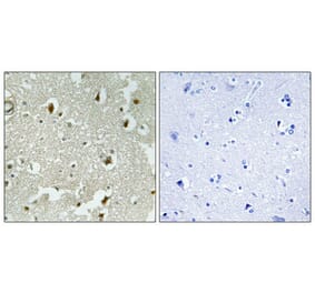 Immunohistochemistry - Anti-p27 Kip1 (phospho Ser178) Antibody (A0966) - Antibodies.com
