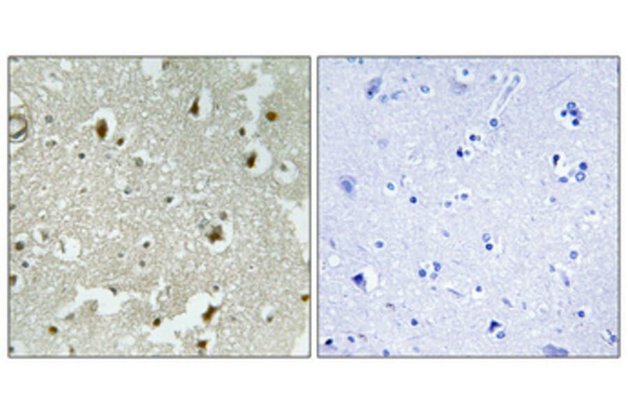 Immunohistochemistry - Anti-p27 Kip1 (phospho Ser178) Antibody (A0966) - Antibodies.com