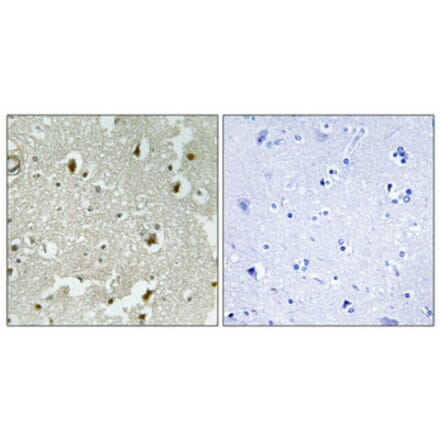 Immunohistochemistry - Anti-p27 Kip1 (phospho Ser178) Antibody (A0966) - Antibodies.com