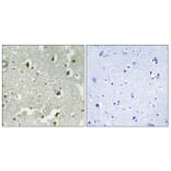 Immunohistochemistry - Anti-p27 Kip1 (phospho Ser178) Antibody (A0966) - Antibodies.com