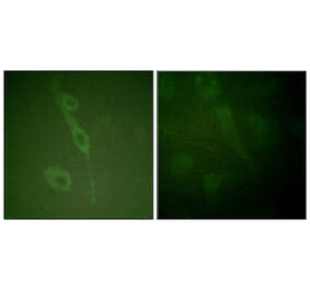Immunofluorescence - Anti-IL-7R (phospho Tyr449) Antibody (A1065) - Antibodies.com