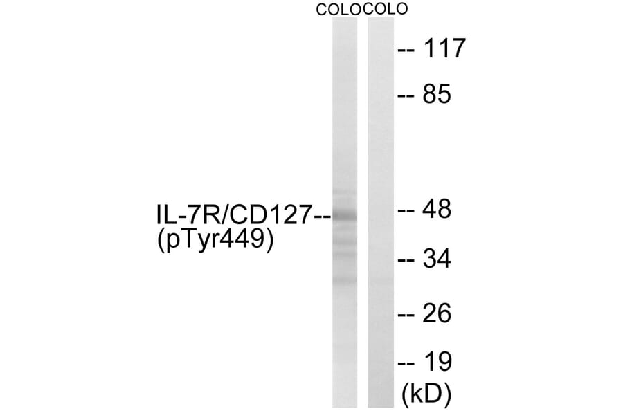 Western Blot - Anti-IL-7R (phospho Tyr449) Antibody (A1065) - Antibodies.com