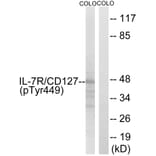 Western Blot - Anti-IL-7R (phospho Tyr449) Antibody (A1065) - Antibodies.com