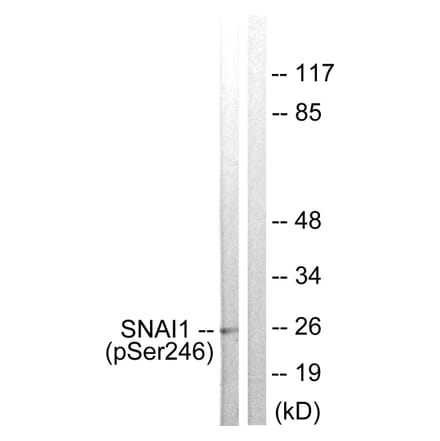 Western Blot - Anti-SNAI1 (phospho Ser246) Antibody (A1235) - Antibodies.com