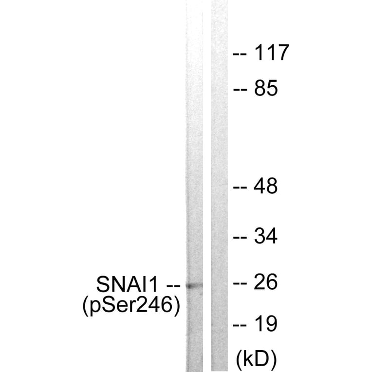 Western Blot - Anti-SNAI1 (phospho Ser246) Antibody (A1235) - Antibodies.com