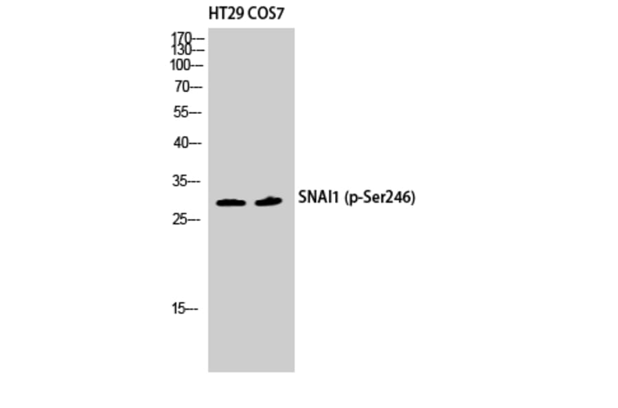 Western Blot - Anti-SNAI1 (phospho Ser246) Antibody (A1235) - Antibodies.com