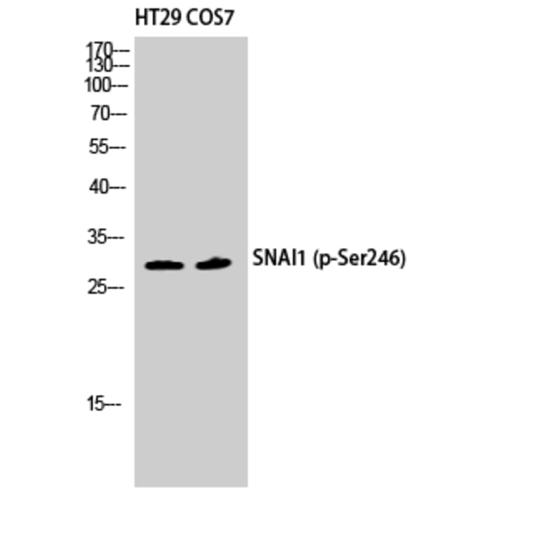 Western Blot - Anti-SNAI1 (phospho Ser246) Antibody (A1235) - Antibodies.com